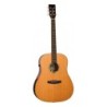 GUITARRA ACÚSTICA TANGLEWOOD SERIE NEW ROSEWOOD SMART DREADNOUGHT ELECTRIFICADA | MÚSICA BILBAO